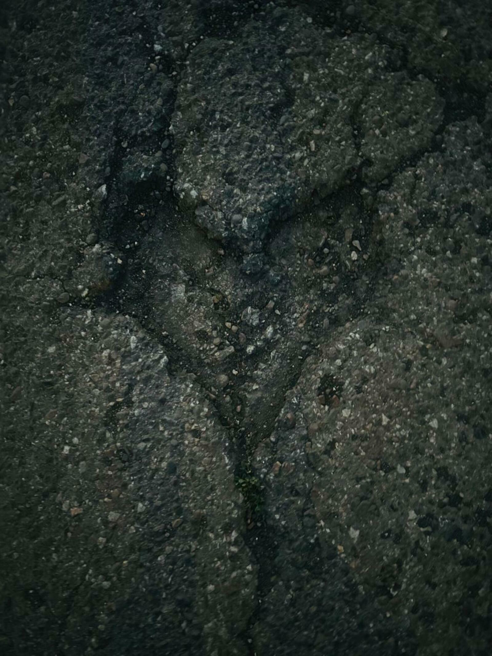 Йөрәкте урынына ултыртыу