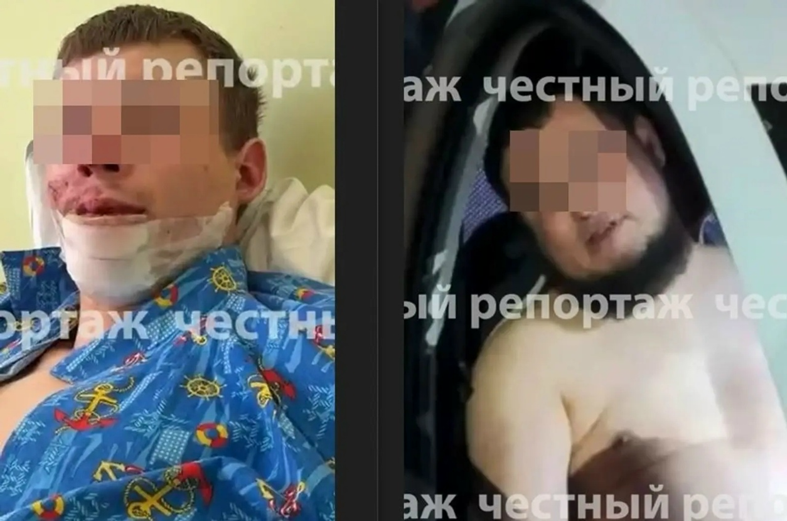 Иҫкәртеү яһаған өсөн... Тәүҙә машина менән бәрҙергән, шунан...